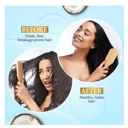 Parachute Advansed Gold Biotin Coconut Hair Oil - All Hair Types, 300 ml