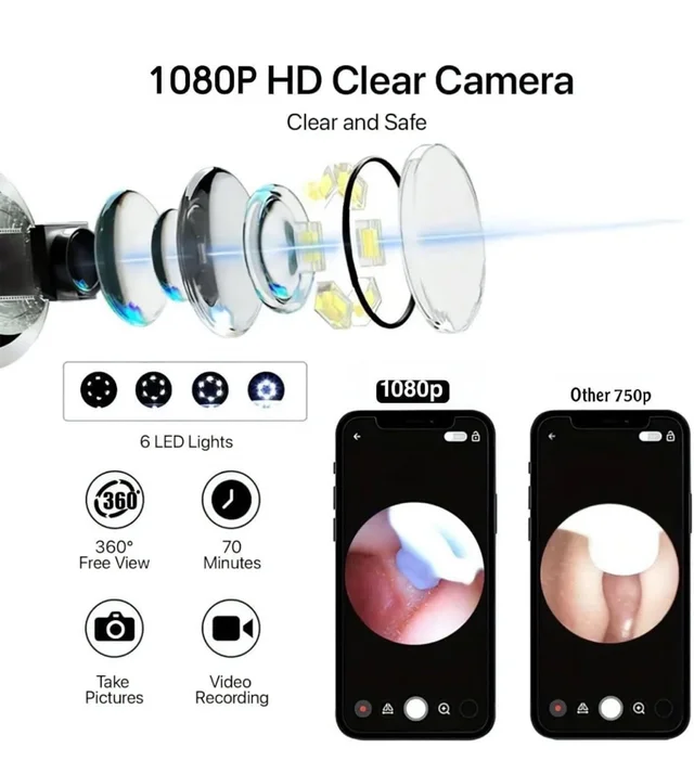 Earocam Earwax Removal Tool Kit with HD Camera WiFi Connection & 6 LED Lights Endoscope Tool Ear Cleaner Set of 8, Otoscope with Light for iOS & Android Kids Children Adults Gift Gadget (6 Months Warranty)
