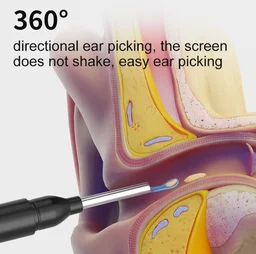 Earocam Earwax Removal Tool Kit with HD Camera WiFi Connection & 6 LED Lights Endoscope Tool Ear Cleaner Set of 8, Otoscope with Light for iOS & Android Kids Children Adults Gift Gadget (6 Months Warranty)